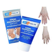 Ảnh sản phẩm Kem dưỡng da tay chống lão hóa giảm gân xanh Kpem Koppektop Nga 1