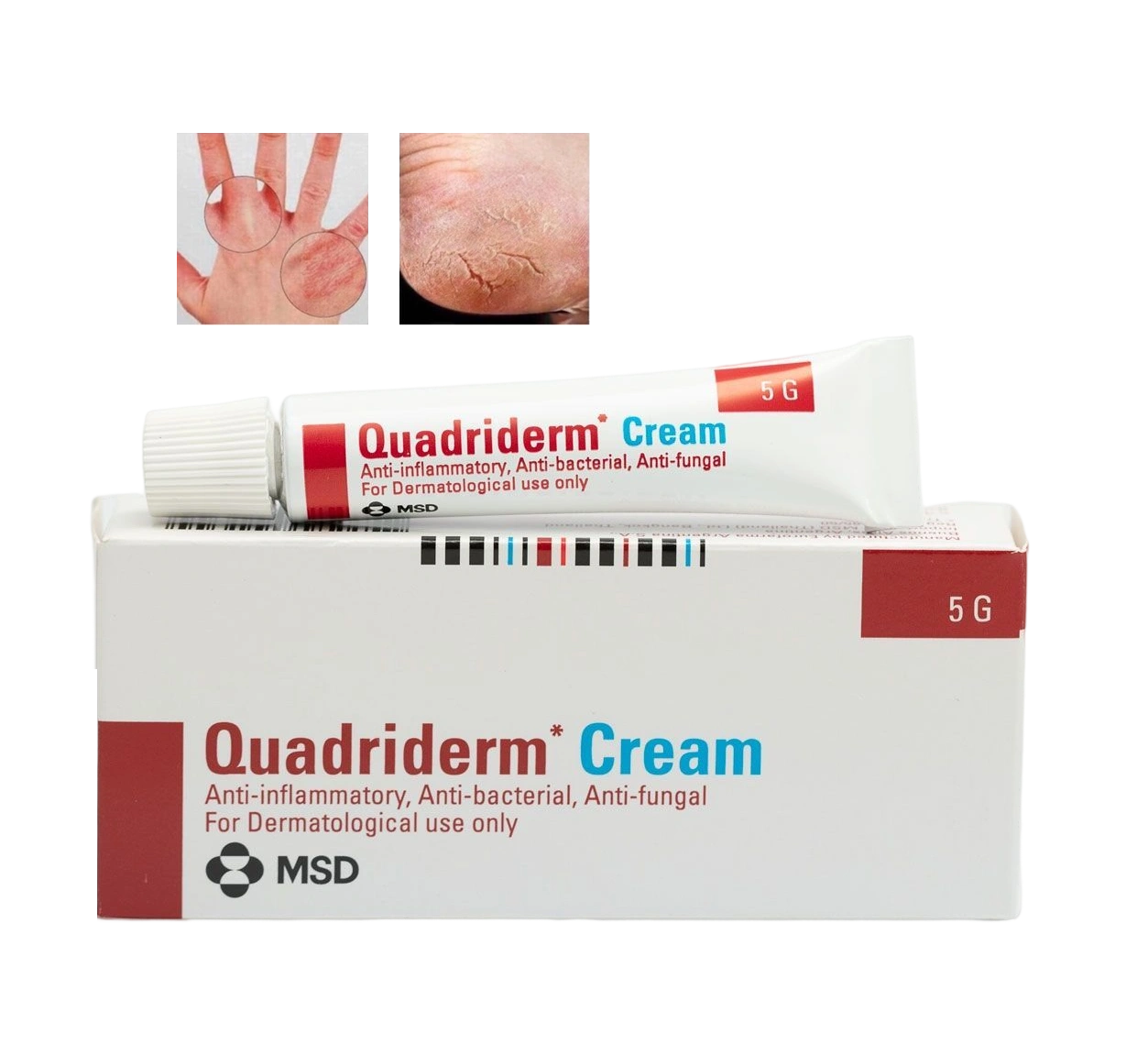 Kem bôi nấm ngứa vẩy nến viêm da Quadriderm Cream