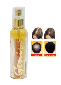 Ảnh sản phẩm Chai xit kích mọc tóc Genive Hair Tonic 1