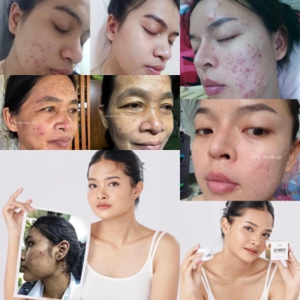 Mặt nạ thạch hữu cơ phục hồi da tổn thương do mụn Lanos Jelly Mask up Organic Thái Lan ảnh 4