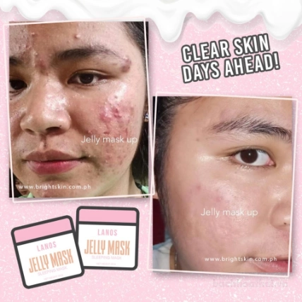 Mặt nạ thạch hữu cơ phục hồi da tổn thương do mụn Lanos Jelly Mask up Organic Thái Lan ảnh 7