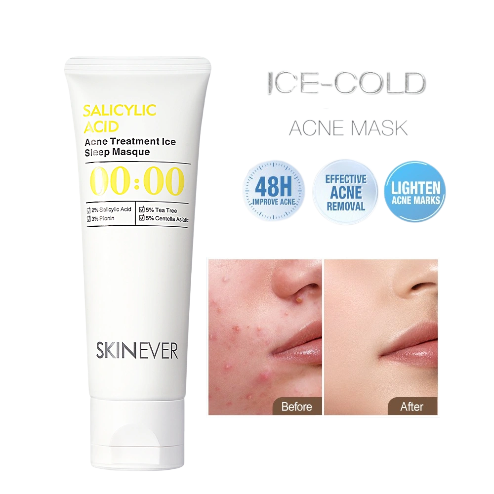 Mặt nạ ngủ cho da mụn SKINEVER Acid Salicylic Ice Sleep Mask