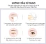 Miếng dán kích 2 mí Double Eyelid Sticker  ảnh 7