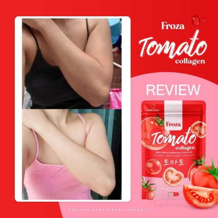 Froza Tomato Collagen dưỡng trắng, sáng da tự nhiên ảnh 5
