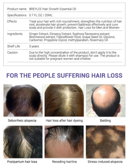 Tinh chất mọc tóc LABENA Breylee Hair Growth Oil kích mọc, ngăn gẫy rụng 20ml ảnh 10