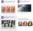 Tinh chất mọc tóc LABENA Breylee Hair Growth Oil kích mọc, ngăn gẫy rụng 20ml ảnh 9
